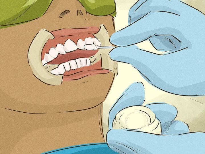 Diş Beyazlatma Nasıl Yapılır