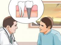 Dental İmplant Tedavisi